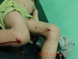 Nyaris Tewas! Bocah 6 Tahun Diserang Buaya Saat Mandi di Sungai, Polisi Imbau Warga Hentikan Aktivitas di Sungai